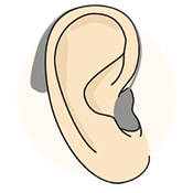 Illustration of Behind the Ear (BTE) Hearing Aids